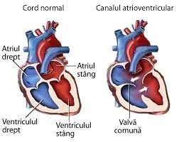 Un ventricul cardiac la scară mai mică
